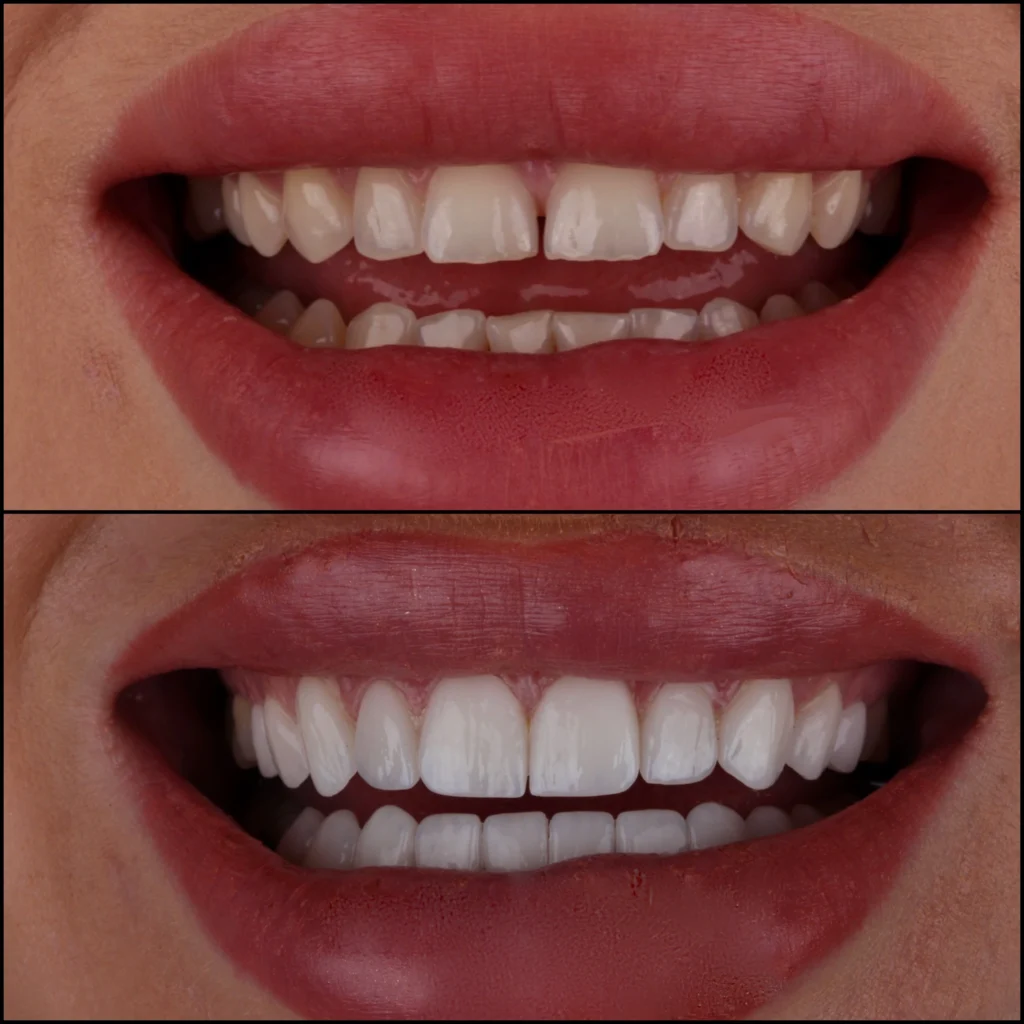 Collage_Fotottr1-ezgif.com-jpg-to-webp-converter-1024x1024