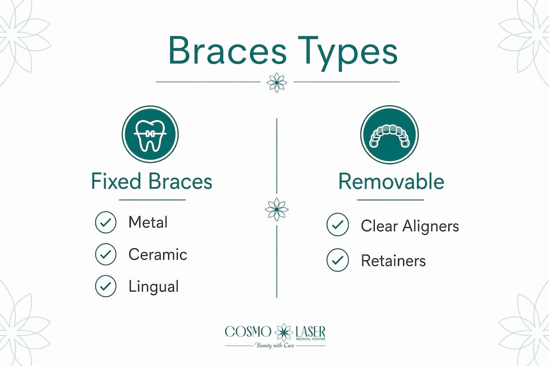 Infographic displaying braces types side-by-side comparison