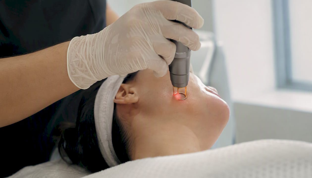 Clinician adjusting laser device on patient skin