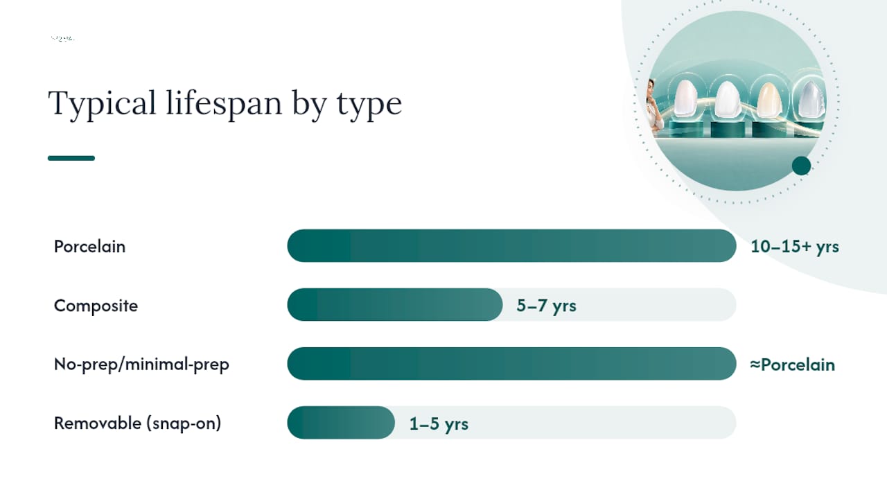 Comparative diagram of dental veneer types and features