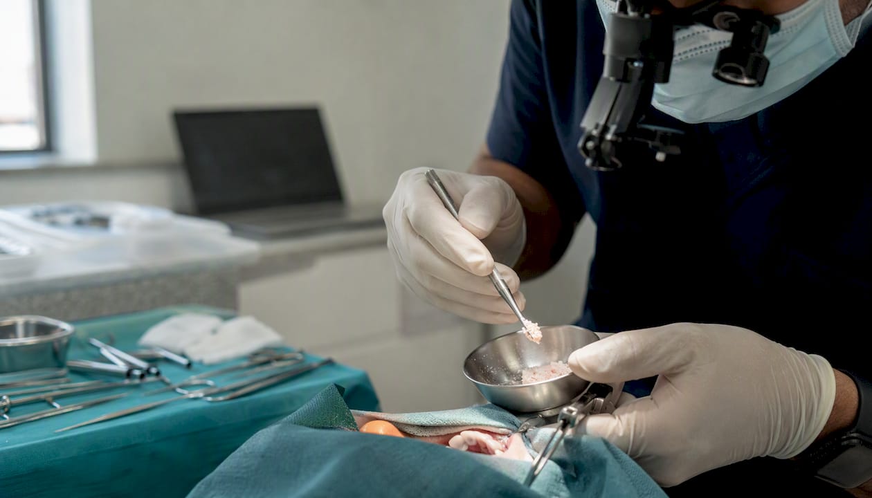Dentist preparing bone graft in dental clinic
