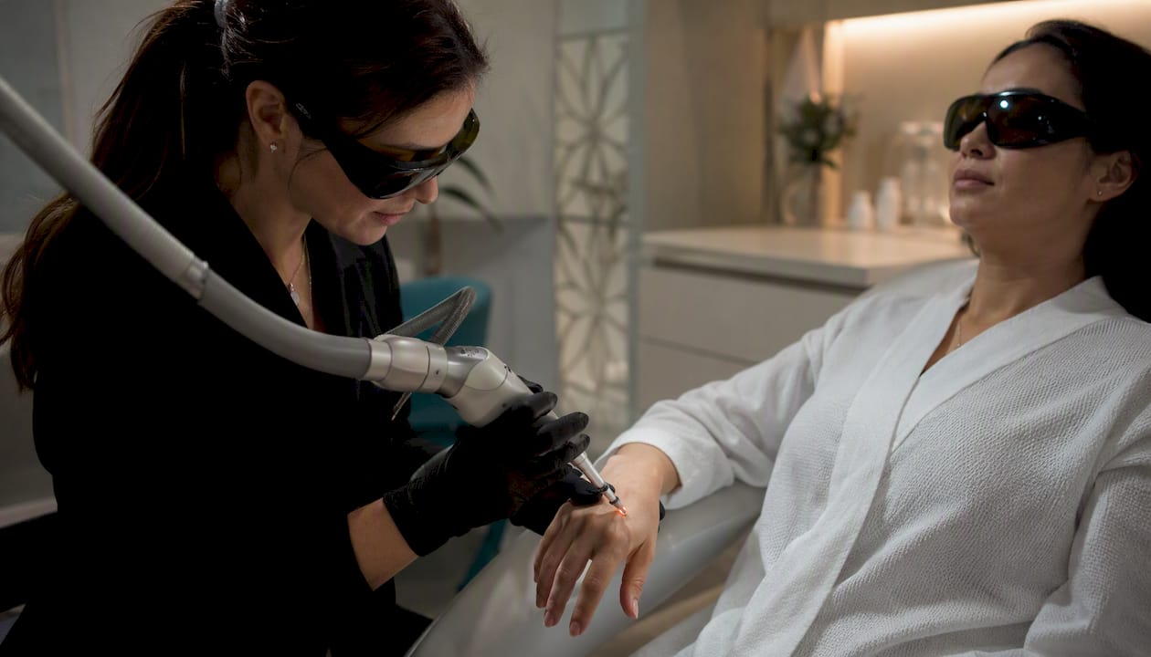 Laser treatment for hand pigmentation