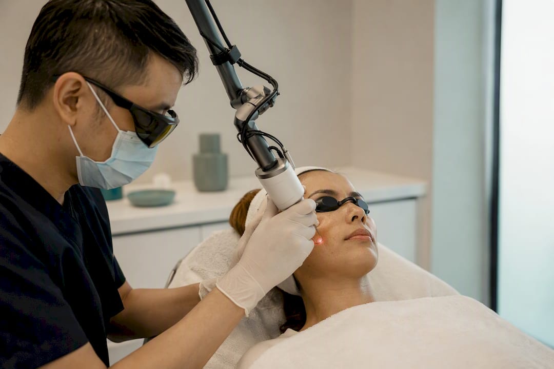 Clinician using Q-Switch laser on facial pigmentation