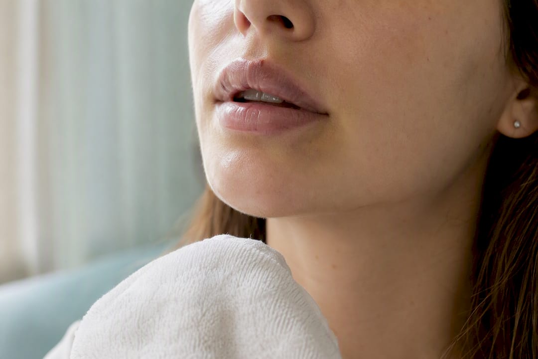 Lips healing with fading bruises day 4